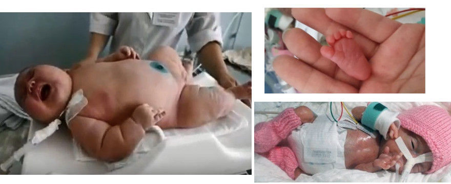 Waga niemowlaka czyli największe i najmniejsze noworodki w historii!