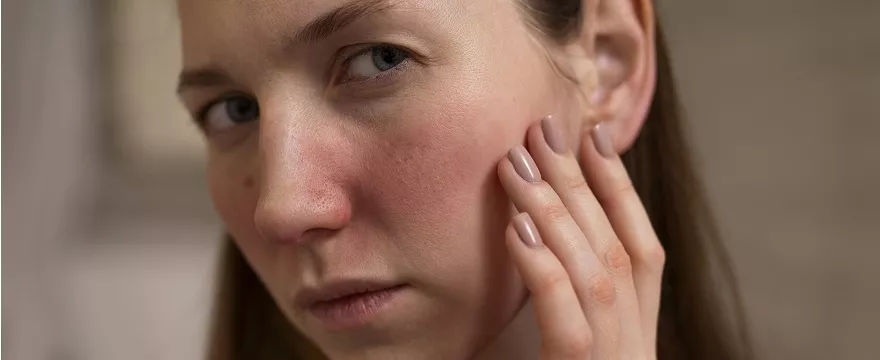 Atopia skóry twarzy: przewodnik po przyczynach, objawach i metodach leczenia