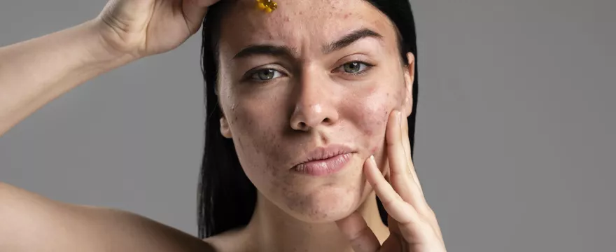 Skóra mamy po ciąży – jak dbać o cerę, która się zmieniła?